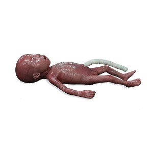초소산아 / 극저체중아(ELBW)  Micro-preemie Baby / Extremely Low Birth Weight Baby (ELBW)  [1024668]