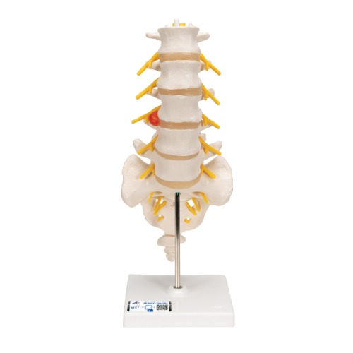 (후외측 배측방) 디스크 요추모형 Lumbar Spinal Column with Dorso A76/5 [1000150]