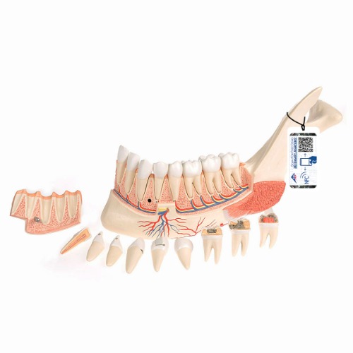 [특별할인] 치아질환이 있는 하악 모형 19-파트 Advanced Half Lower Jaw with 8 diseased teeth 19 part VE290 [1001250]