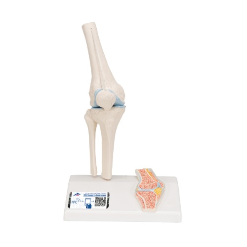 관절 단면이 포함된 소형(미니) 무릎 관절(슬관절) 모형 Mini Human Knee Joint Model with Cross Section A85/1 [1000170]