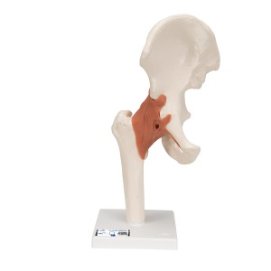 엉덩이 관절 (고관절) 모형 Functional Hip Joint A81 [1000161]