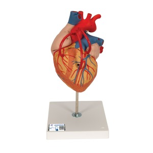 관상동맥 우회술 심장모형 실제크기2배 4-파트 Heart with Bypass 2 times life size 4 part G06 [1000263]