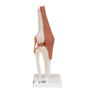 무릎관절(슬관절) 모형  Functional Knee Joint A82 [1000163]