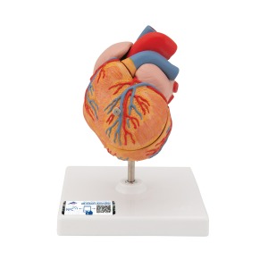 좌심실비대(LVH) 심장모형 2-파트 Classic Heart with Left Ventricular Hypertrophy (LVH) 2 part G04 [1000261]