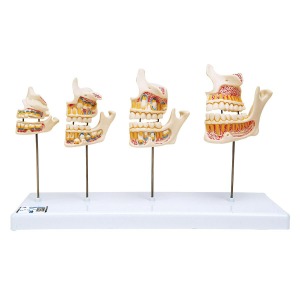 [특별할인] 치아 성장 모형 Dentition Development D20 [1000248]