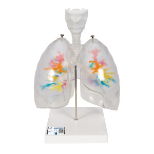 후두와 투명한 폐 있는 수상가지모형 CT Bronchial Tree with Larynx and Transparent Lungs G23/1 [1000275]