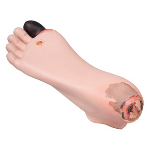 당뇨 발 치료 모형 Decubitus Foot Treatment TrainerP14 [1018815]