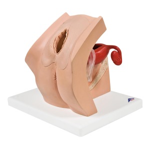 부인과 교육용 모형(여성생식기) Model for Gynecological Patient Education P53 [1013705]