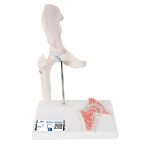 [특별할인] 관절 단면이 포함된 소형(미니) 엉덩이 관절(고관절) 모형 Mini Hip Joint with cross-section A84/1 [1000168]