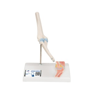 관절 단면이 포함된 소형(미니) 팔꿈치 관절(주관절) 모형 Mini Human Elbow Joint Model with Cross Section A87/1 [1000174]