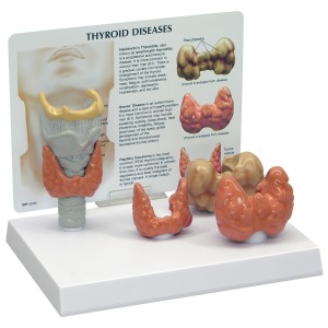 갑상선 모형 Thyroid Model - W33370[1019548]