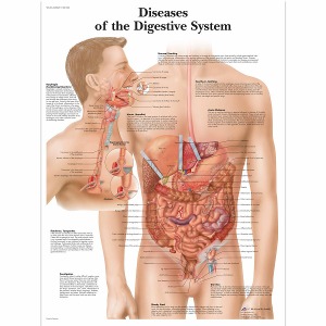 소화기 질환 차트 Diseases of the Digestive System Chart VR1431L [1001548]
