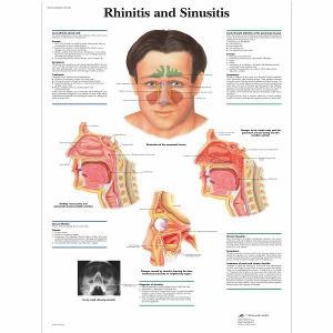 비염과 축농증 차트 Rhinitis and Sinusitis Chart VR1251L [1001504]