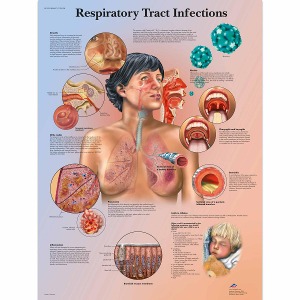 기도 감염(호흡기 감염) 차트 Respiratory Tract Infections Chart VR1253L [1001508]