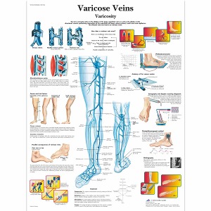 정맥류 차트 Varicose Veins Chart VR1367L [1001534]