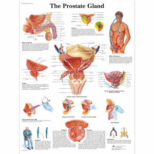 전립선 차트 The Prostate Gland Chart VR1528L [1001566]