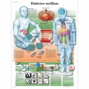 당뇨병 차트 Diabetes Mellitus Chart VR1441L [1001554]
