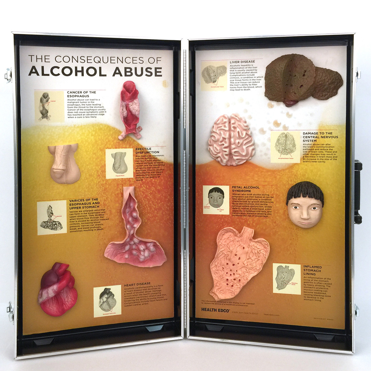 &quot;알코올 중독의 결과” 3D 게시판 Alcohol Abuse Consequences 3-D Display W43053 [1005582]