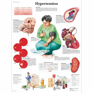고혈압 차트 Hypertension Chart VR1361L [1001532]