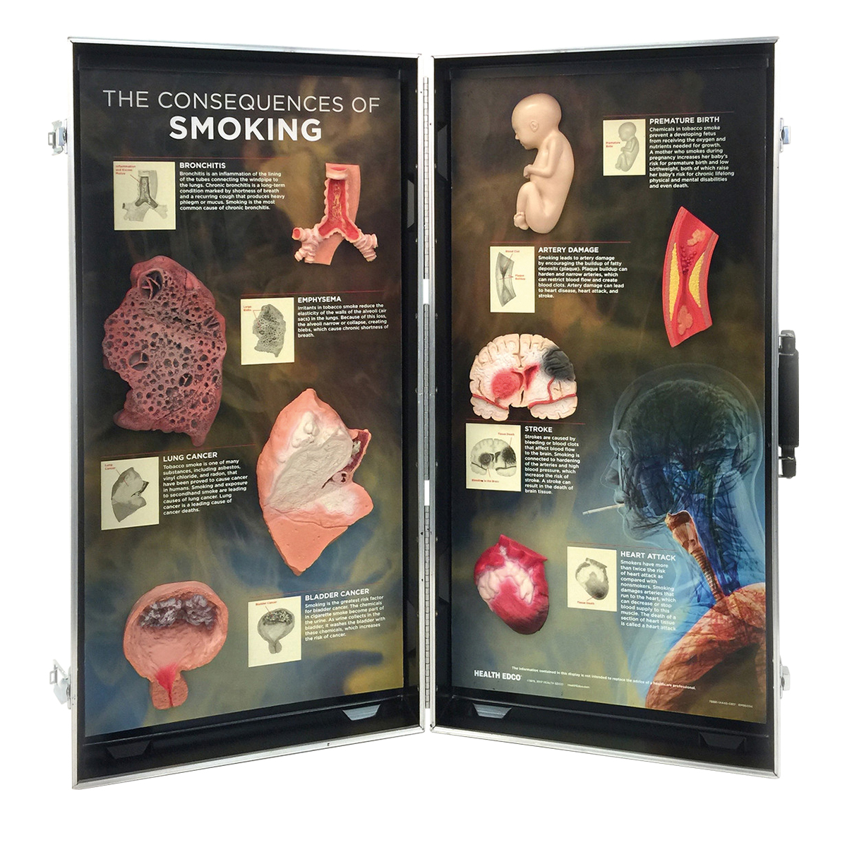 흡연의 결과 3D 게시판 Consequences of Smoking, 3D Info Board W43047 [1005580]