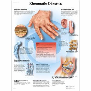 류마티스 질환 차트 Rheumatic Diseases Chart VR1124L [1001476]