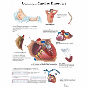심장질환 차트 Common Cardiac Disorders Chart VR1343L [1001526]