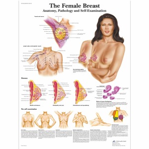 여성 유방 차트 - 해부학, 병리학 및 자가 검사 Female Breast Chart - Anatomy, Pathology and Self-Examination VR1556L [1001576]