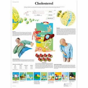 콜레스테롤 차트 Cholesterol Chart VR1452L [1001558]
