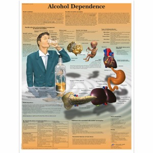 알코올 중독 차트 Drug Dependence Chart VR1792L [1001620]