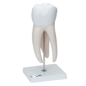 치아우식증이 있는 상악대구치 모형, 6파트 Giant Molar with Dental Cavities Human Tooth Model D15 [1013215]
