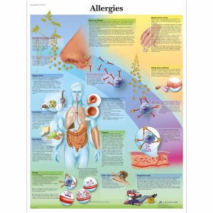 알레르기 차트 Allergies Chart VR1660L [1001596]